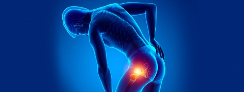 dolore_gluteo_coscia_sindrome_piriforme